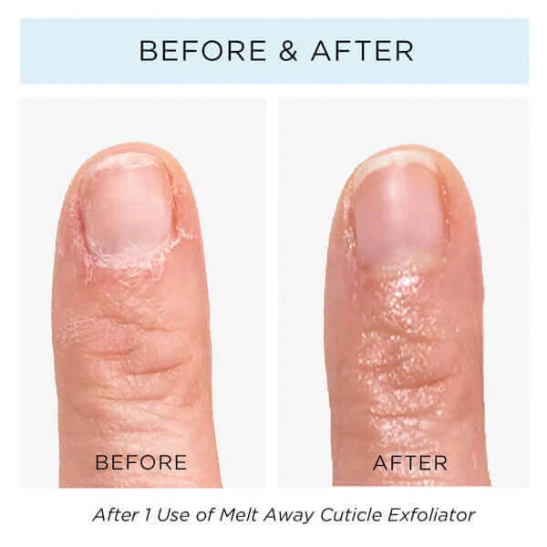 Melt Away Cuticle Exfoliator 2 Melt Away Cuticle Exfoliator - Image 2