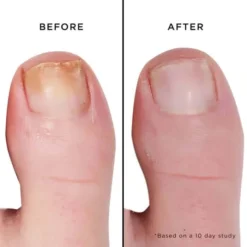 Fashion Size Mellow The Yellow Nail Brightening Treatment -Butter London Store mini mellow the yellow nail brightening treatment 488829